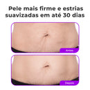 Firmelle – Creme Firmador Abdominal Que Devolve a Firmeza e Suaviza as Estrias